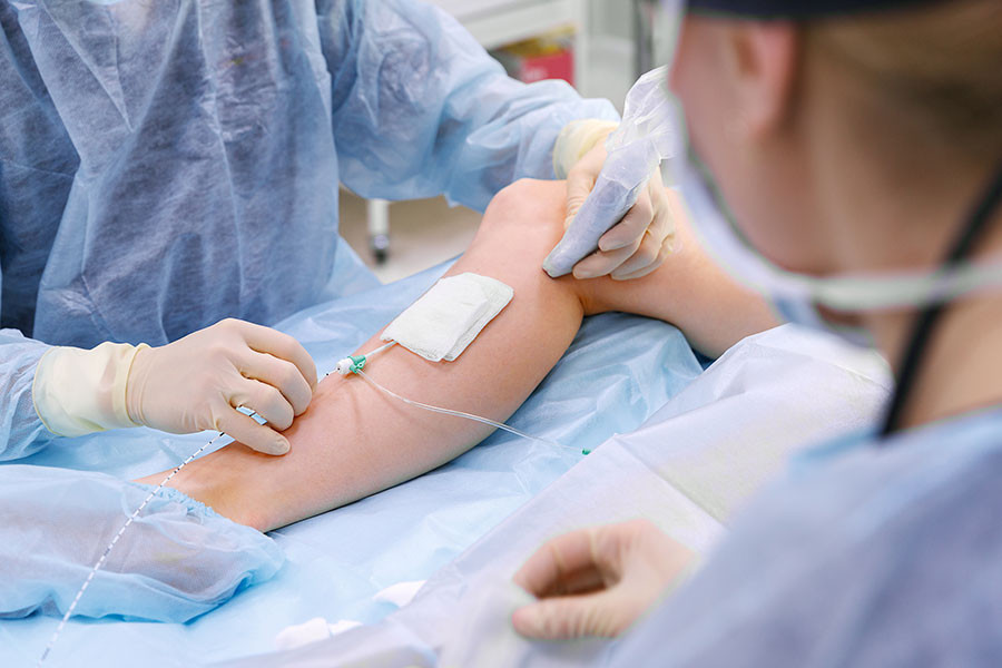 Varicose veins symptoms