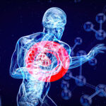 carotid artery disease