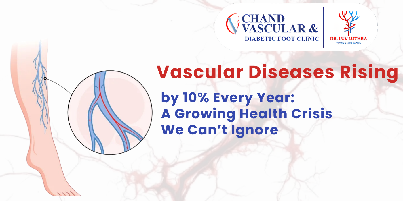 Vascular surgeon performing varicose vein treatment in Ludhiana clinic