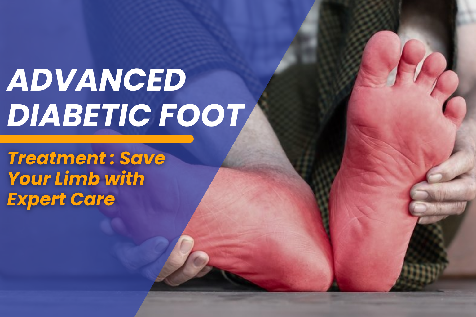 Best doctor for diabetic foot treatment in Ludhiana Dr. Luv Luthra providing advanced limb salvage and wound care treatment