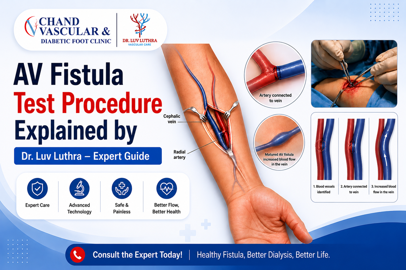 Vascular specialist Dr. Luv Luthra performing AV fistula test procedure in Punjab for dialysis access evaluation and vascular care.